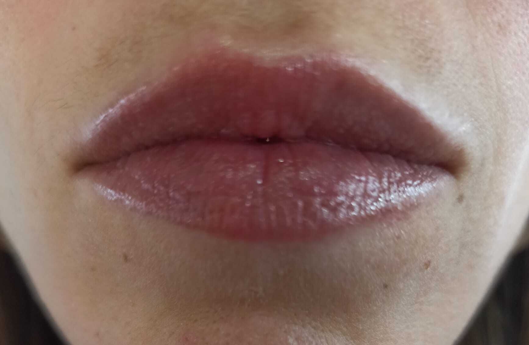 Labios Carnosos Y Hidratados Aumento Labios 4757