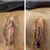 Evolución labioplastia