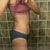 Lipolaser Bodytite 1 semana después
