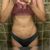 Lipolaser Bodytite 1 semana después
