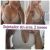 Mastopexia periareolar 500 cc ergonomicas mamas tuberosas con el Dr. Daniel Marin (Sevilla)