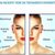 Hilos tensores con vitaminas para rejuvenecer el rostro