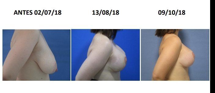 59173