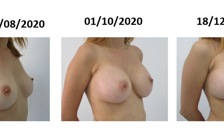 115099