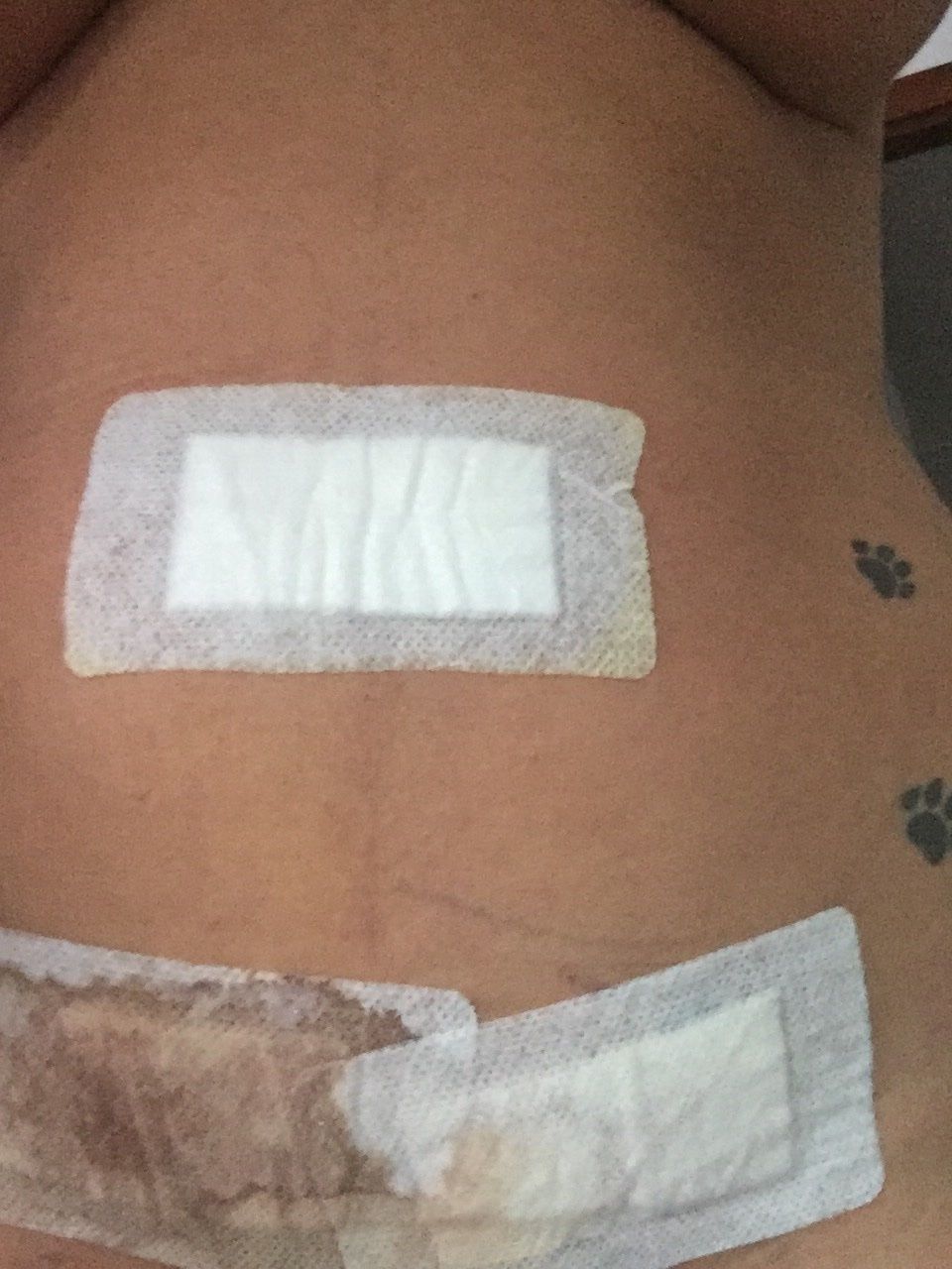 Doctor Céspedes una gran profesional - Liposucción - Multiestetica.com