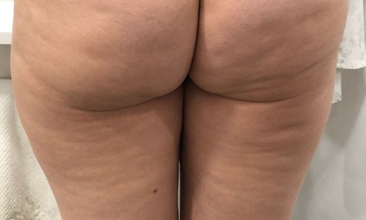 65784