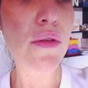 Love my New Lips! Encantada con el tratamiento - 56365