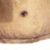 Abdominoplastia 6 semanas