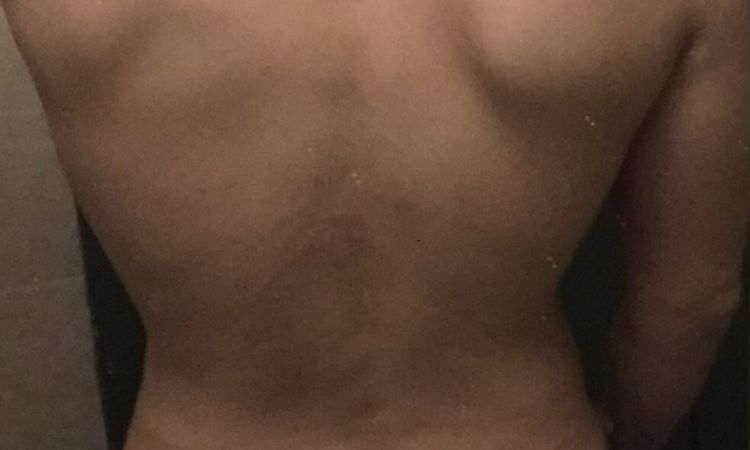 118314
