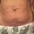 Me ayudó mucho con mi barriga despues del parto