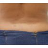 Encantada con la Criolipólisis en abdomen y muslos
