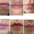Aumento de labios Salamanca