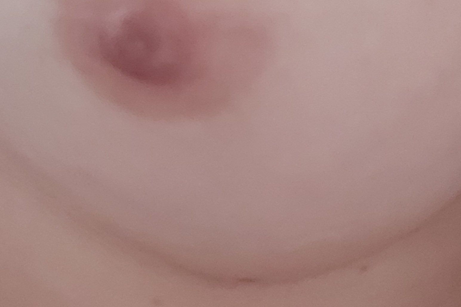 20826