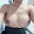Mastopexia de 300cc firme alto con lipolaser