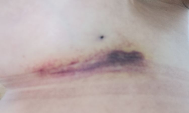 23311