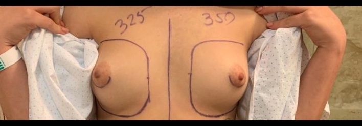 15423