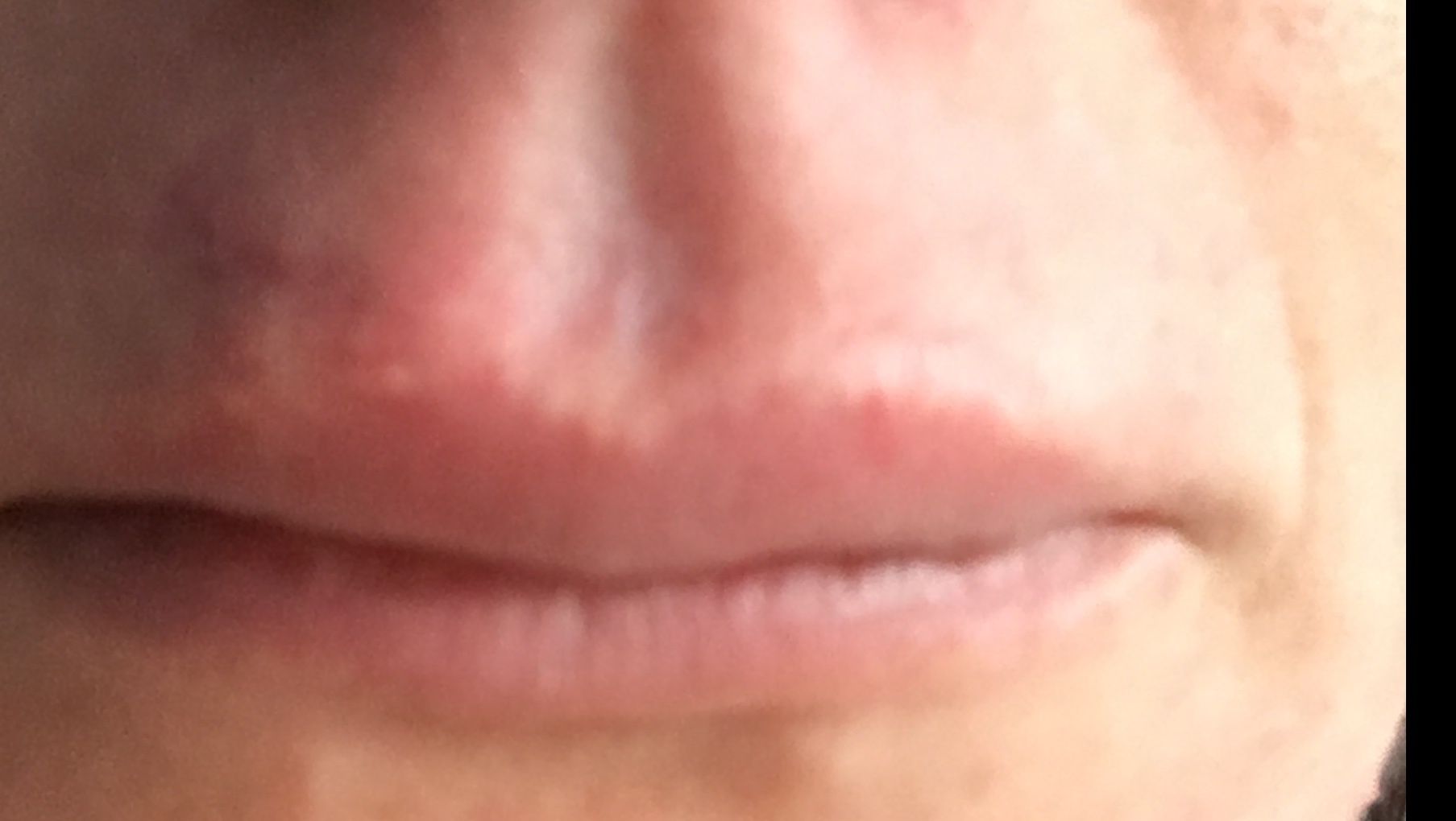 8251