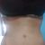1 semana de mi Abdominoplastia y no me veo plana..