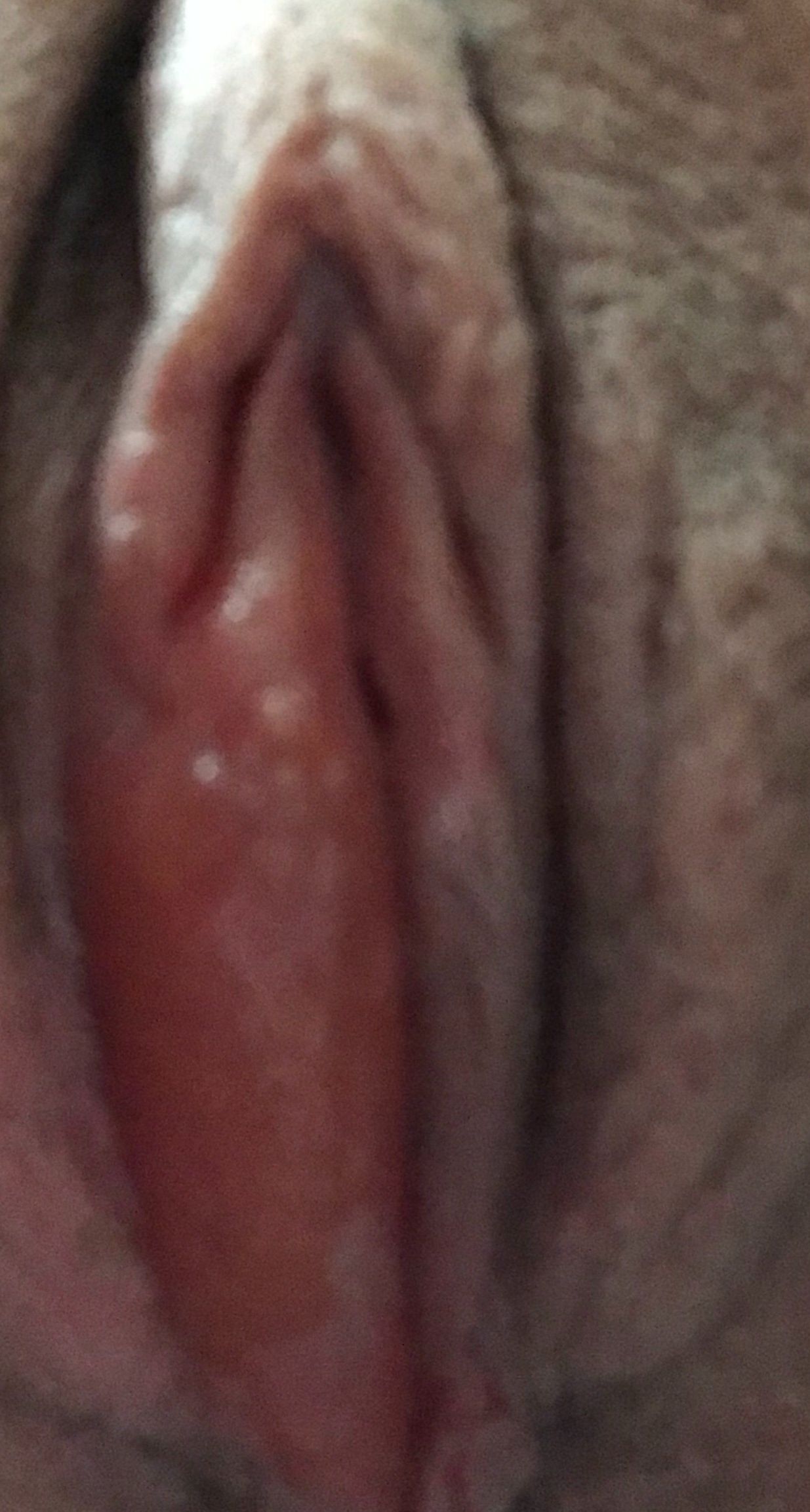 984