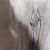 Labioplastia 2do dia