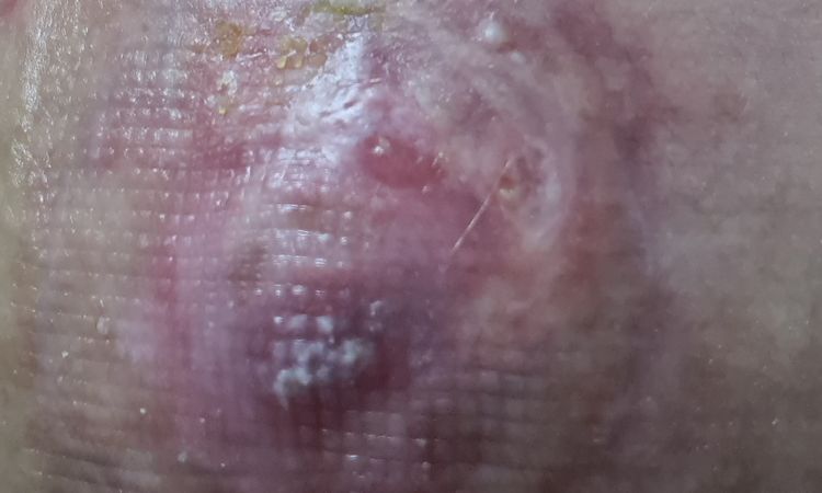 22595
