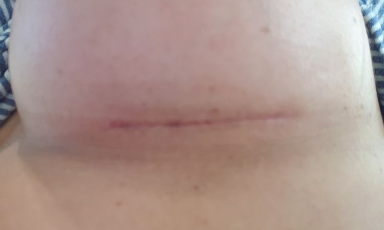 7911