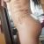 Lo que no contaron de la gluteoplástia de prótesis