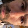 Rinoplastia hombre piel gruesa
