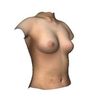Primera consulta de aumento de pecho, simulacion 3D, que tal lo veis?