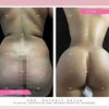 Lipoescultura 360+gluteos molde Vixen/latino