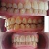 Duda sobre resultado final ortodoncia