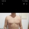 LipoVaser con doctora Claudia Liuzza