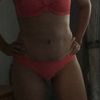Es normal esto en una abdominoplastia
