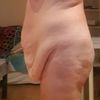 Me quiero operar de abdominoplastia