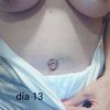Mi abdominoplastia,operada el 9 de septiembre