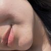 Me han arreglado el destrozo de los labios!!