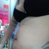 Dudas de lipoescultura con marcacion 