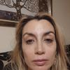 Tratamiento ojeras mal hecho