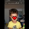 Se que ya había preguntado pero estoy muy triste por verle la oreja así a mi hijo