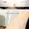 Horrible sensación de frustración aumento de pecho