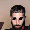 Resultado pésimo frontal rinoplastia