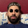 Resultado pésimo frontal rinoplastia