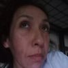 Radiesse  sobre rostro