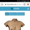 Simulación aumento pecho en 3d