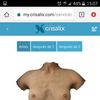 Simulación aumento pecho en 3d