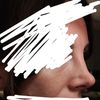 Rinoplastia desconforme