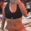 Lipofilling de mamas