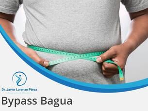 Bypass Bagua 13500