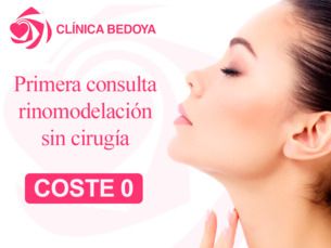 Primera consulta sin coste