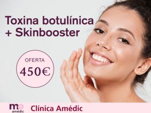 Toxina Botulínica + Skinbooster